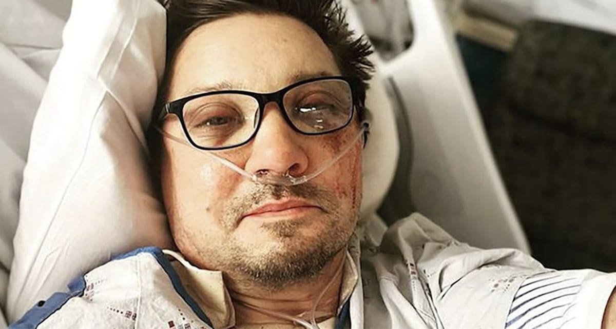 Jeremy Renner Reveals He Broke More Than 30 Bones in Snow Plow Accident [Photo]
