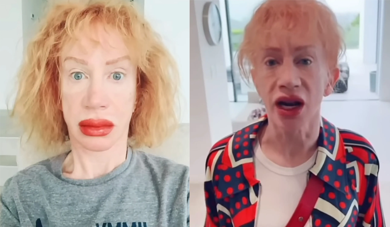Yikes: Kathy Griffin Shocks Fans with Red, Swollen, Lips After ‘Blushing’ Tattoo Procedure [Video]
