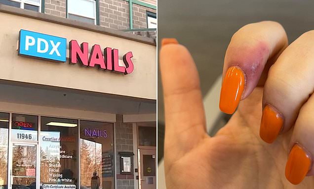 Say What Now? Woman Claims Acrylic Manicure Gave Her Herpes
