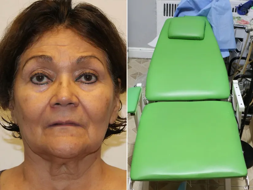 Say What Now? Woman Accused of Operating ‘Unsanitary’ Dentistry From Kitchen of Her One-Bedroom Apartment [Video]