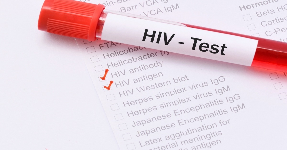 Get Tested, Stay Protected: Observing HIV Testing Day (June 27)
